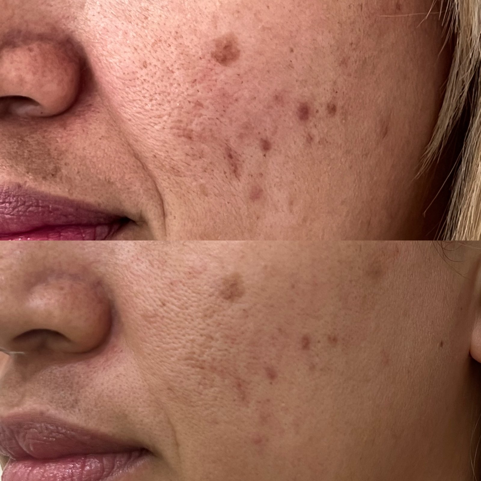 Facial SUMAQ Iluminada (D-cool)